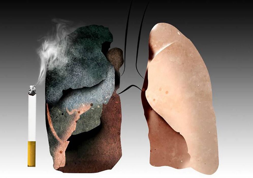 smoker's lungs